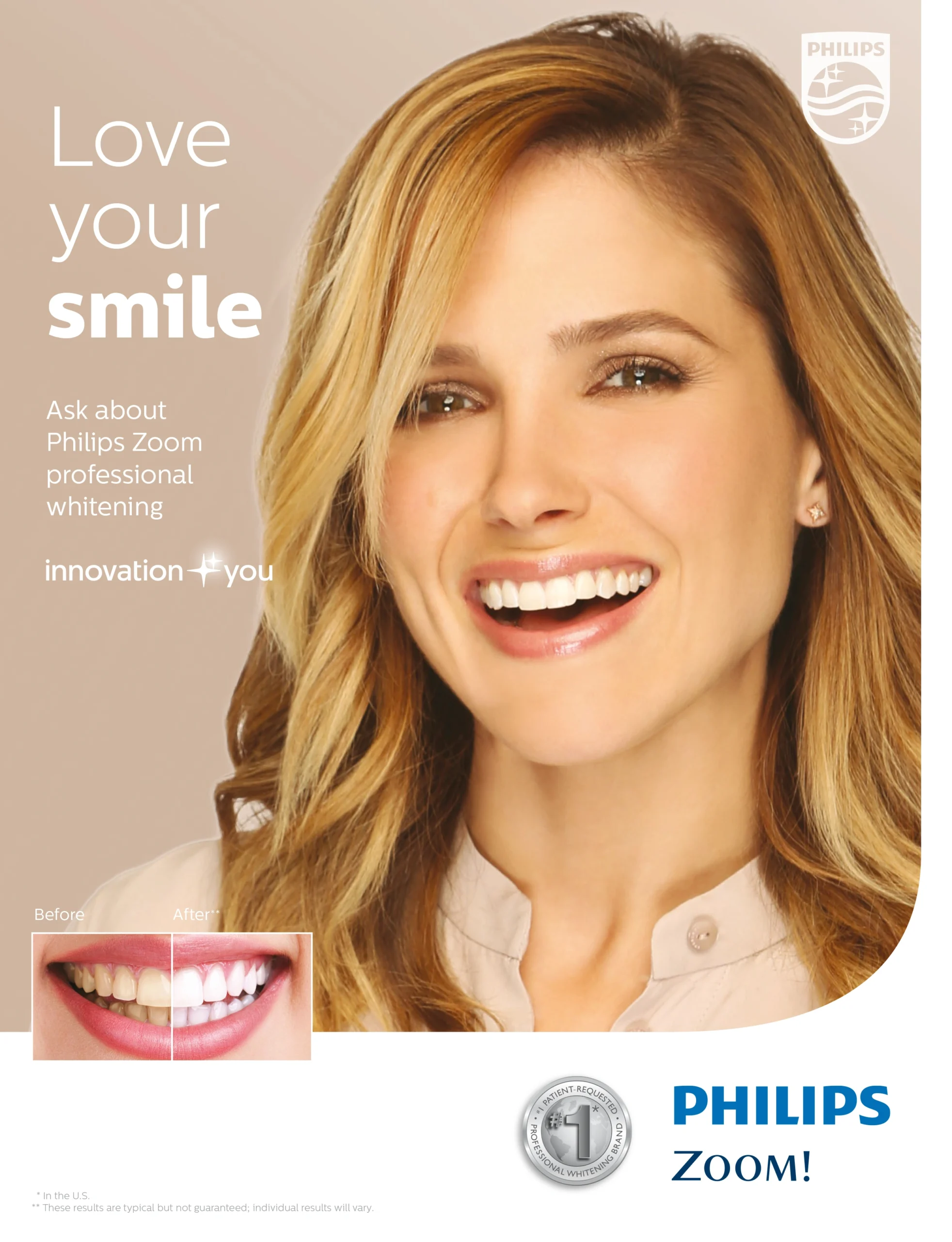 Woman smiling brightly displaying white teeth, Philips Zoom teeth whitening advertisement for Hometown Dental.