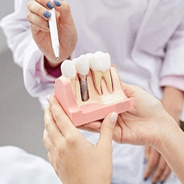 Dentist demonstrating dental implant model to patient in clinical setting.